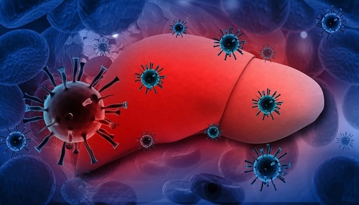 Viêm gan virus có thể lây nhiễm và tiến triển thành xơ gan